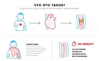 Как отличить сердечный приступ от панической атаки