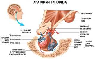 Характеристики, симптомы, причины и лечение кисты гипофиза