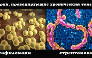 Профилактика хронического тонзиллита у взрослых