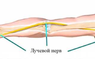 Защемление нерва в руке – что делать при неприятных симптомах