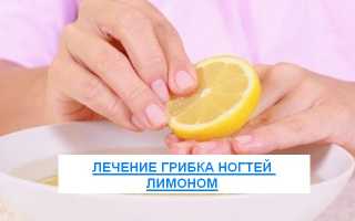 Лечение грибка между пальцами ног
