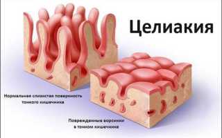 Что такое безглютеновая диета и как составить меню на неделю?