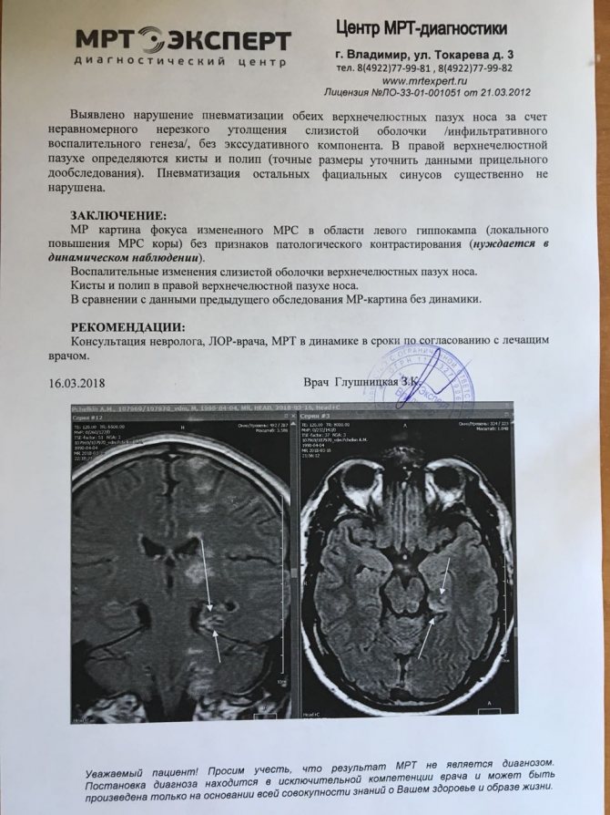 МРТ2 11ed7