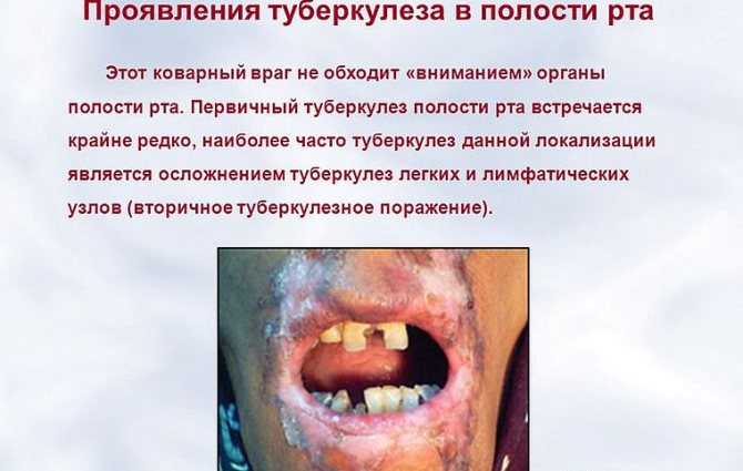 проявления